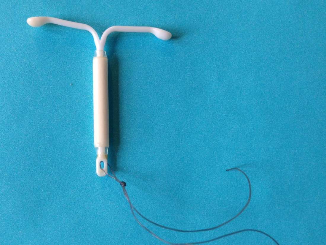 Breast cancer and Mirena IUD: What