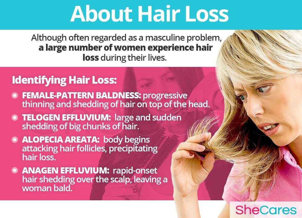 Hair Loss is often regarded as a masculine problem, however, a large ...