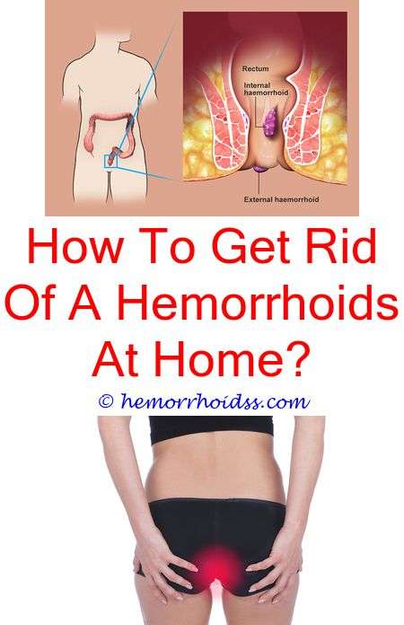How Do You Know If You Have Internal Hemorrhoids? how to ...