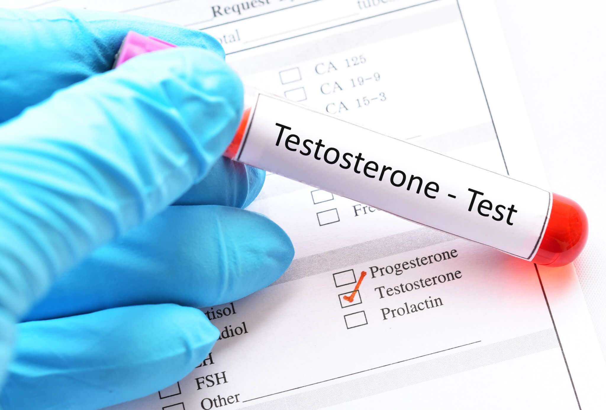 How does low testosterone affect male fertility ...