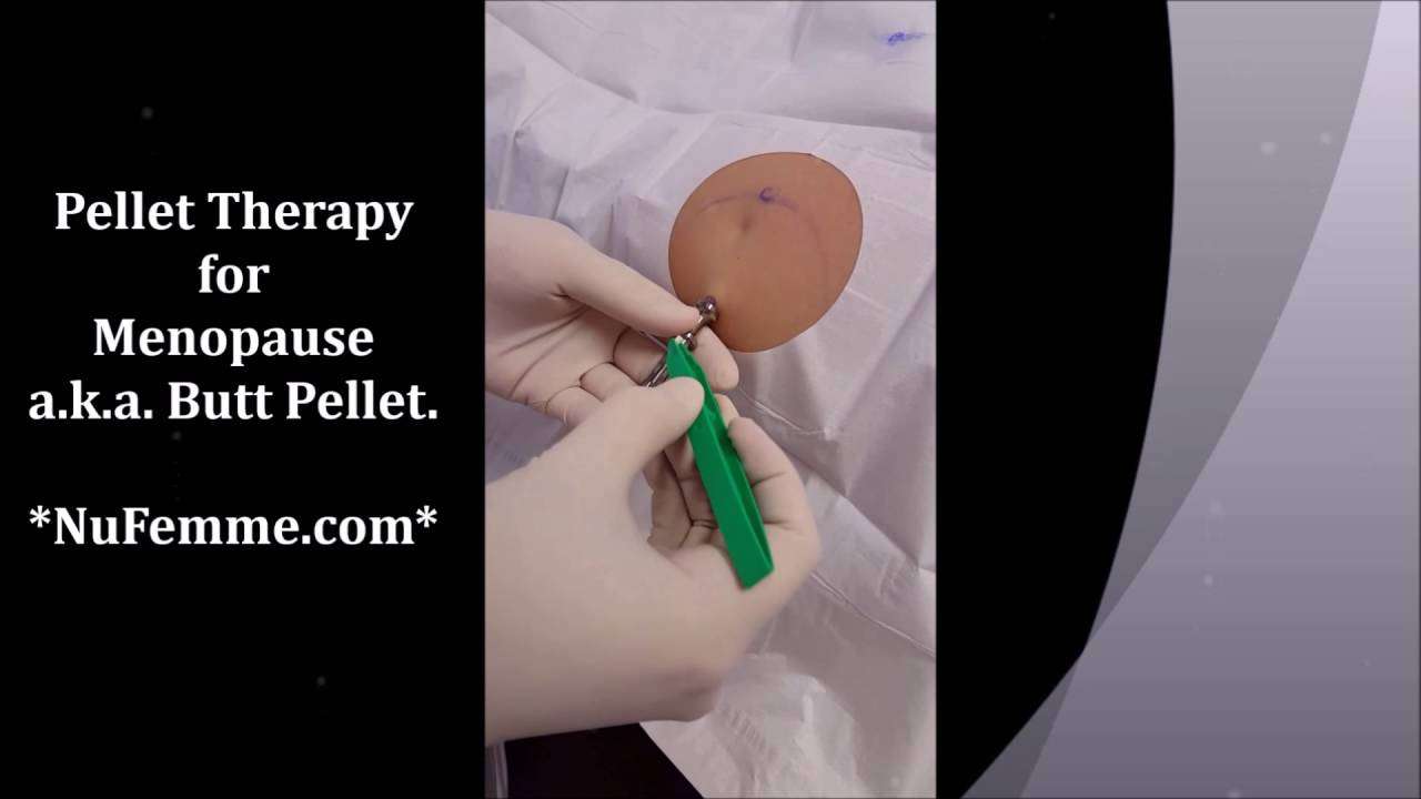 Watch a Hormone Pellet Insertion Procedure ~ Pellet ...
